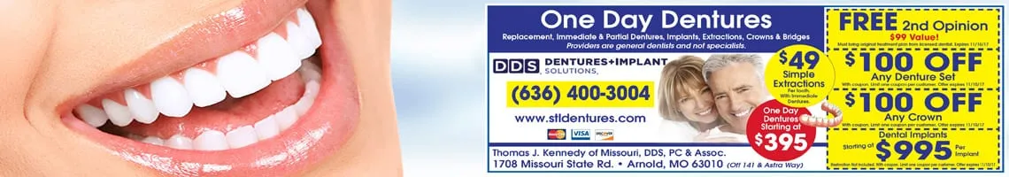 dentures collinsville il dental work